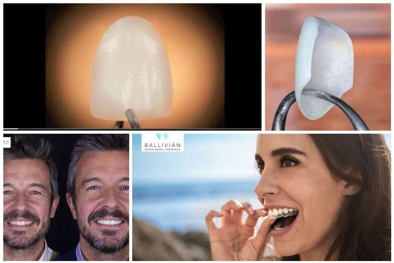 La clínica mejora con las carillas ultrafinas la estética de la sonrisa (Foto TA)
